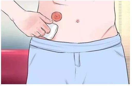 居家造口护理的那些事儿(图2) 居家造口护理的那些事儿(图2)